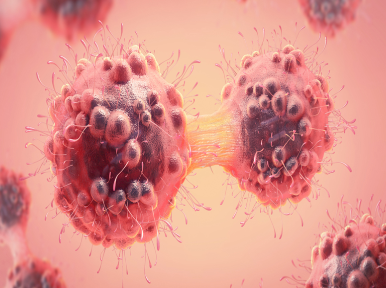 Cancer Risning Uganda Intensifies Fight Against Rising Cancer Burden Amid Calls for ...